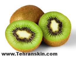 کیوی