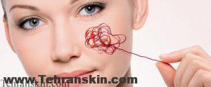 آکنه و آنتی بیوتیک ها آکنه و آنتی بیوتیک ها
