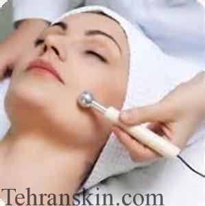 لیزر با دستگاه IPL لیزر با دستگاه IPL