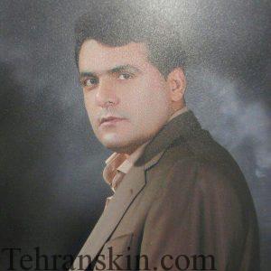 معرفی یکی از بهترین مراکز لیزر موهای زاید یزد معرفی یکی از بهترین مراکز لیزر موهای زاید یزد