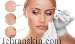 تزریق بوتاکس برای چه کسانی ممنوع است ؟ تزریق بوتاکس برای چه کسانی ممنوع است ؟