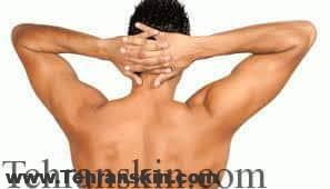 لیزر موهای زائد بدن آقایان