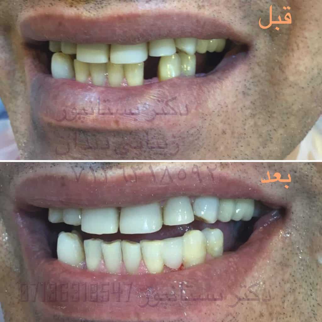 معرفی مرکز تخصصی دندانپزشکی دکتر بستانپور در شیراز IMG 20180113 113602 903 1 - معرفی مرکز تخصصی دندانپزشکی دکتر بستانپور در شیراز
