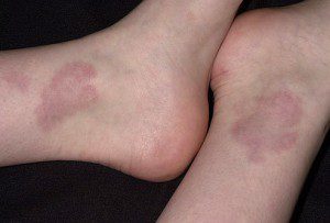 پوست درباره سلامتی شما چه می گوید؟