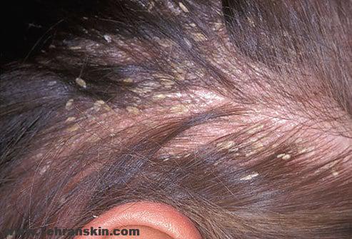 پوست و موی سر در مورد سلامتی شما چه می گویند