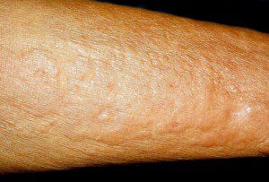 پوست درباره سلامتی شما چه می گوید؟