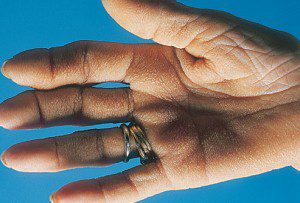 پوست درباره سلامتی شما چه می گوید؟