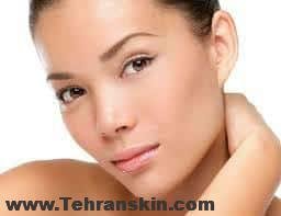 پوسته پوسته