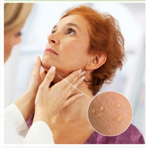 تگ های پوستی