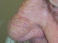 راینوفایما