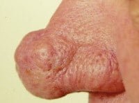 راینوفایما