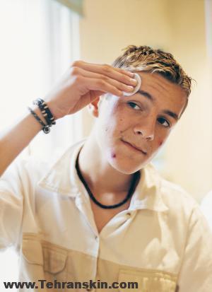 نقش سالسیلیک اسید در درمان آکنه