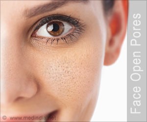 منافذ باز پوست