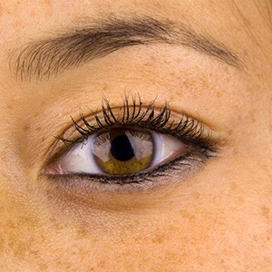 how_to_correct_sun_damage_on_your_skin