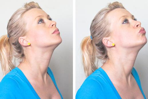 بوسه بر سقف برای کاهش سایز غبغب