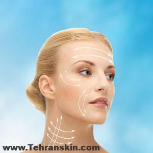 کاربرد دستگاه لاغری با سیستم RF