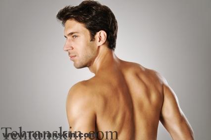 Image result for ‫لیزر درمانی برای موهای زائد مردان‬‎