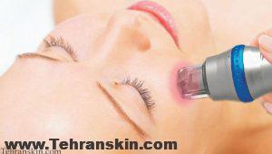 رادیوفرکوئنسی