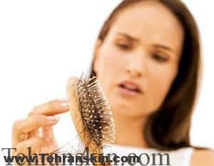اف پی اچ ال - ریزش مو منجر به طاسی در زنان