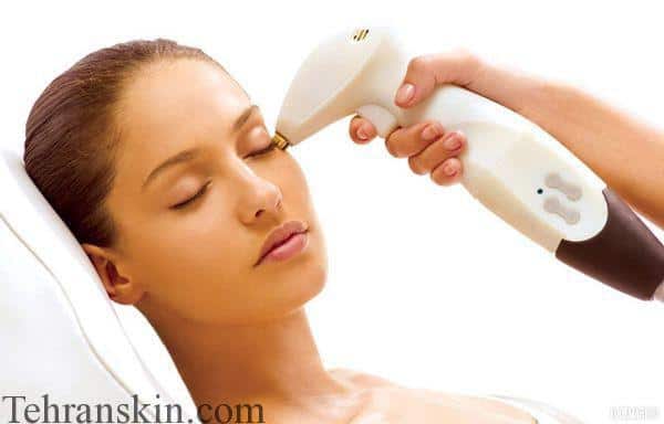نتیجه تصویری برای لیزر سرد برای جوانسازی پوست