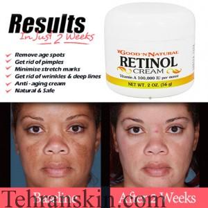 Retinol