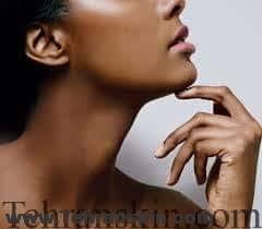 مراقبت از گردن