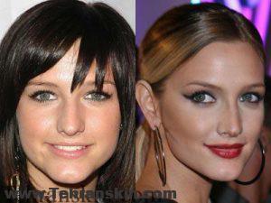 پاسخ به همه سؤال های شما در مورد تزریق بوتاکس ، قیمت ، عوارض و ماندگاری بوتاکس