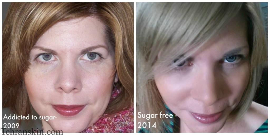 ترک اعتیاد به قند و شکر