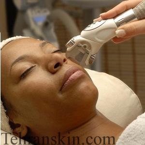 جوانسازی صورت0