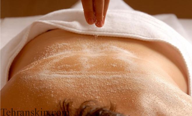 شکر و لایه برداری پوست