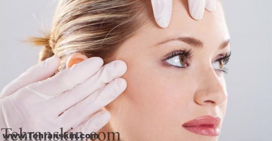 کشیدن صورت با جراحی