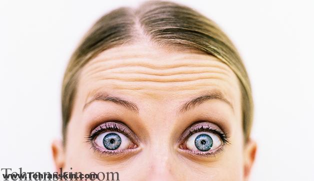 بهترین روش کاهش چین و چروک پیشانی