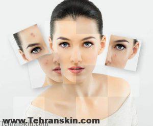 what-is-laser-skin-rejuvanation