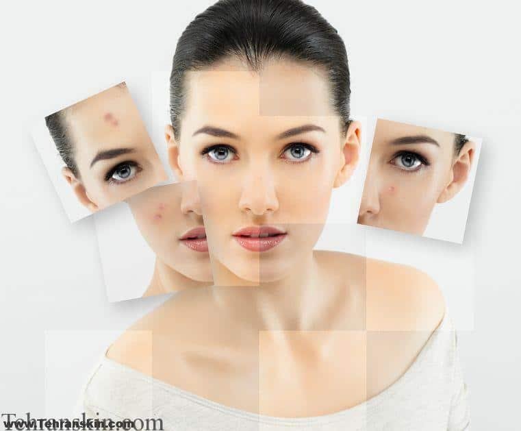 بهترین روش جوانسازی پوست