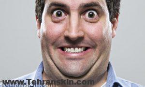 Man with double chins