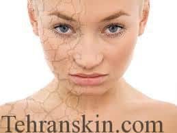 مرطوب کننده