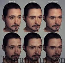 چروک پیشانی 2