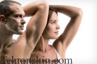 لیزر موهای زائد زیربغل