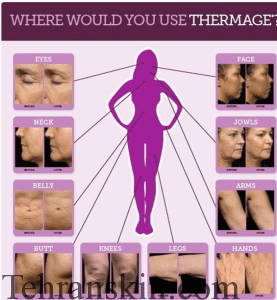 20140228162913_26314