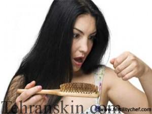 Mesotherapy-Treatment-for-Hair-Loss-320x240