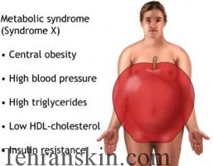 Metabolic Syndrome2