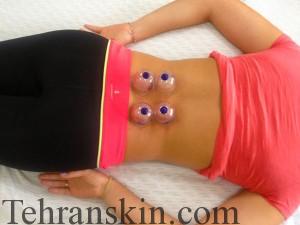 VacuumTherapy_avantitherapy