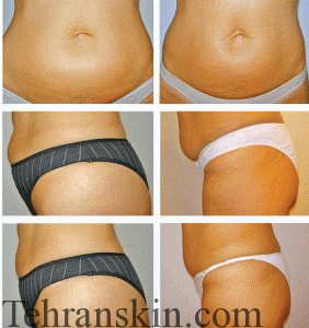 رادیوفرکوئنسی