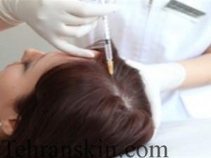 hair-loss-injections-jubilee-hills-hyderabad-treatment-centre