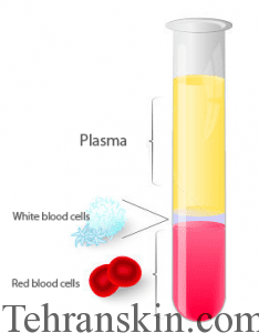 روش جدا کردن پلاکت خون