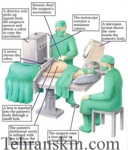 robot_surgery