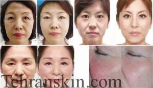 upload-105-945-1769957287