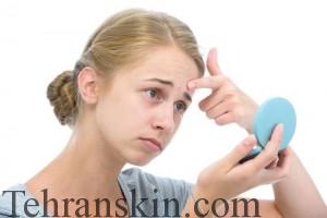 انواع جوشها