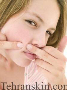 Teenage girl popping zit on face