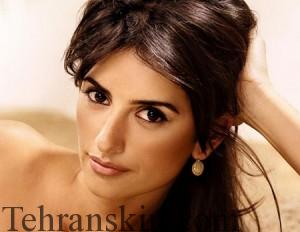 فیتزپاتریک 3